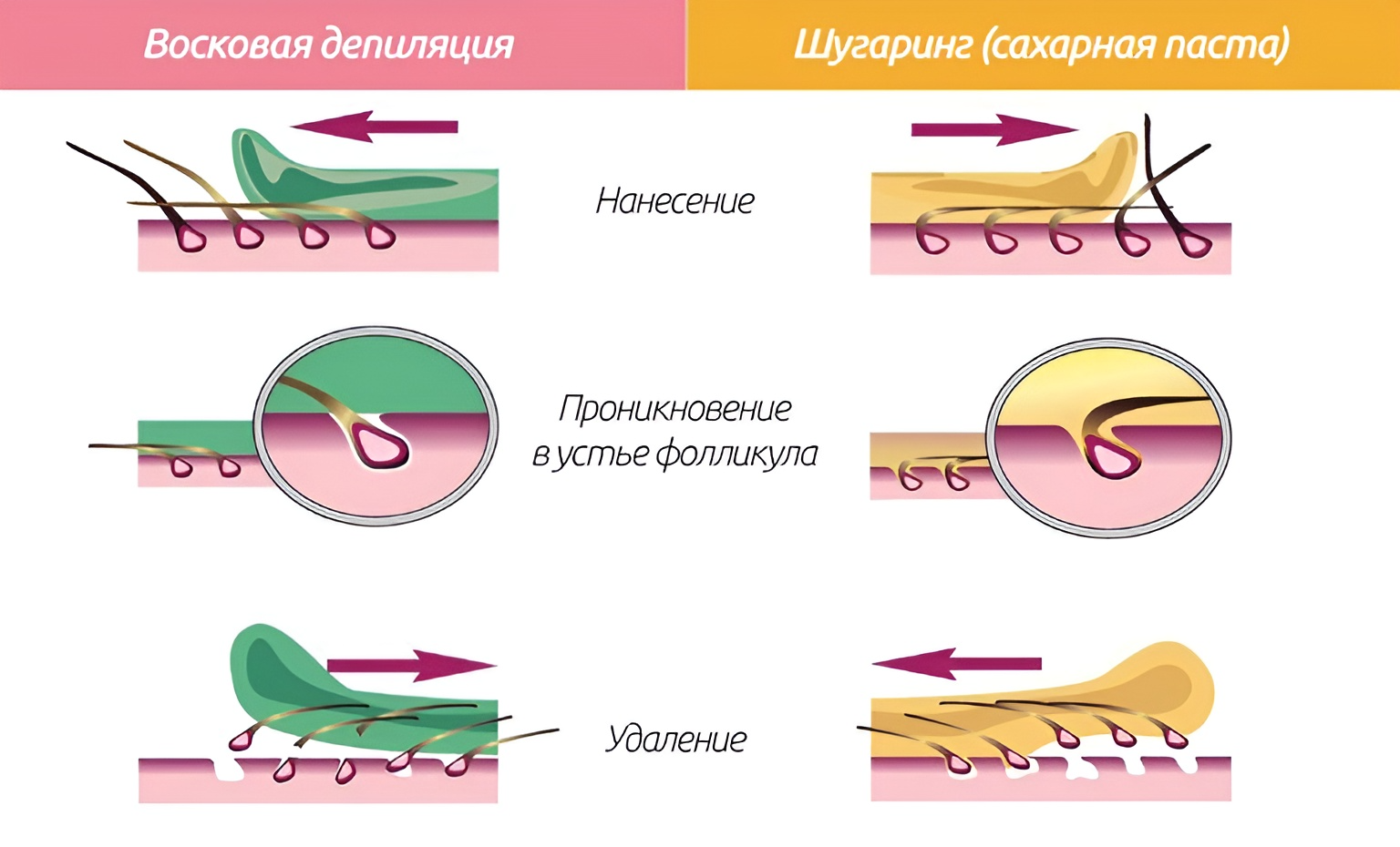 Что Такое Шугаринг Картинки