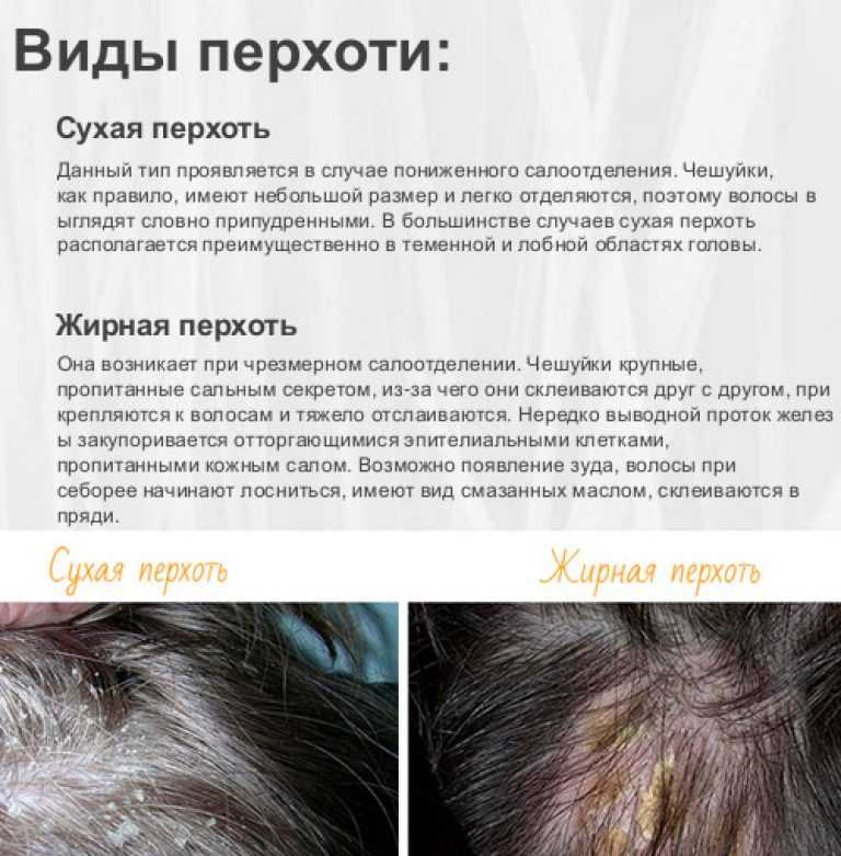 Клетки кожи постоянно обновляются и кожа головы не исключение Чрезмерное скопление омертвевших частиц может стать причиной затруднения питания волосяных фолликул повышения жирности появления перхоти и даже выпадения волос Тщательно и