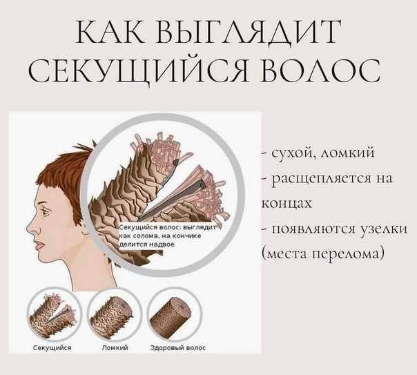 Ломкие и очень сухие волосы: что делать и как восстановить здоровье локонов, рекомендации по уходу и лечению